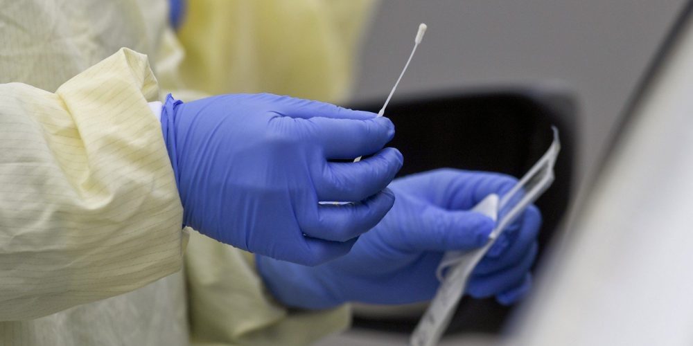 You Tested Positive for Covid-19. Now What?